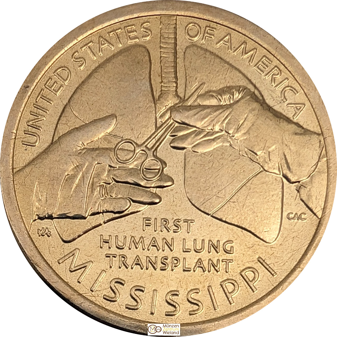 Mississippi - Innovationen, Erste Lungentransplantation, Buchstabe nach Vergügbarkeit
